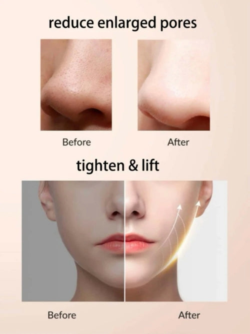 Aparat facial pentru curațare Inovative Peeling